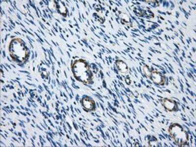 Immunohistochemistry-Paraffin: Aconitase 2 Antibody (3G8) [NBP2-02241] - Staining of paraffin-embedded Ovary tissue using anti-Aconitase 2 mouse monoclonal antibody.