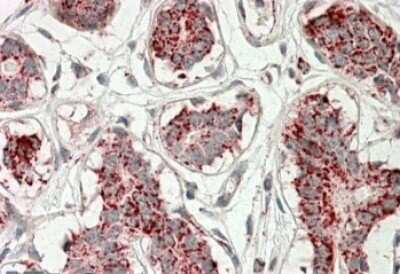 Immunohistochemistry-Paraffin: Aconitase 2 Antibody [NBP1-52015] - (3.8ug/ml) staining of paraffin embedded Human Breast. Steamed antigen retrieval with citrate buffer pH 6, AP-staining.