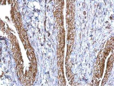 Immunohistochemistry-Paraffin: Aconitase 2 Antibody [NBP2-15245] - Paraffin-embedded mouse urinary bladder.  Aconitase 2 antibody [N1N3] ) dilution: 1:500.