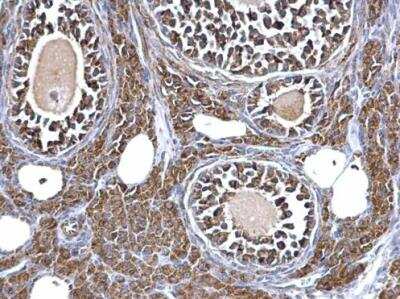 Immunohistochemistry-Paraffin: Aconitase 2 Antibody [NBP2-15245] -  Paraffin-embedded mouse ovary. Aconitase 2 antibody [N1N3] dilution: 1:500