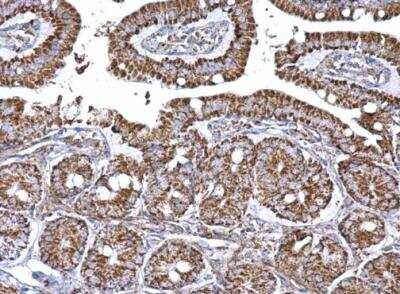 Immunohistochemistry-Paraffin: Aconitase 2 Antibody [NBP2-15245] - Paraffin-embedded mouse intestine.  Aconitase 2 antibody [N1N3]  dilution: 1:500.