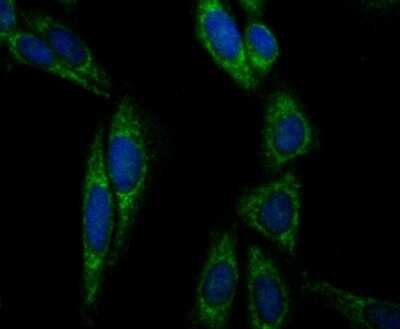 Immunocytochemistry/Immunofluorescence: Aconitase 2 Antibody (JE40-83) [NBP2-75394] - Staining Aconitase 2 in SiHa cells (green). The nuclear counter stain is DAPI (blue). Cells were fixed in paraformaldehyde, permeabilised with 0.25% Triton X100/PBS.