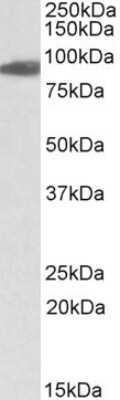 Western Blot: Aconitase 2 Antibody [NBP1-52015] - Analysis of Aconitase 2 (aa541-555) in Heart lysate (35ug protein in RIPA buffer) using this antibody at 0.01ug/ml. Primary incubation was 1 hour. Detected by chemiluminescence.