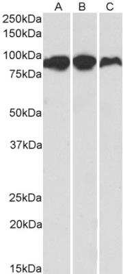 Western Blot: Aconitase 2 Antibody [NBP1-52015] - Analysis of Human (A), Mouse (B) and Rat (C) Adipose lysates (35 ug protein in RIPA buffer). Primary incubation was 1 hour. Detected by chemiluminescence.