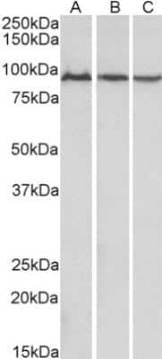 Western Blot: Aconitase 2 Antibody [NBP1-52015] -  Analysis of Mouse (A), Rat (B) and Pig (C) Skeletal Muscle lysates (35 ug protein in RIPA buffer). Primary incubation was 1 hour. Detected by chemiluminescence.