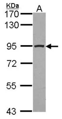 Western Blot: Aconitase 2 Antibody [NBP2-15245] - Sample (30 ug of whole cell lysate) A: JurKat 7.5% SDS PAGE Aconitase 2 antibody, antibody diluted at 1:1000.