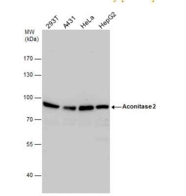 Western Blot: Aconitase 2 Antibody [NBP2-15245] -  Various whole cell extracts (30 ug) were separated by 7.5% SDS-PAGE, and the membrane was blotted with Aconitase 2 antibody diluted by 1:1000.