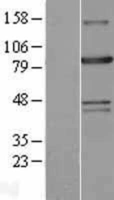 Western Blot: Aconitase 2 Overexpression Lysate (Adult Normal) [NBL1-07244] - Western Blot experiments.  Left-Control; Right -Over-expression Lysate for ACO2