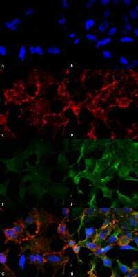 Immunocytochemistry/Immunofluorescence: Acrolein Antibody (2H2) [NBP2-59358] - Immunocytochemistry/Immunofluorescence analysis using Mouse Anti-Acrolein Monoclonal Antibody, Clone 2H2 (NBP2-59358). Tissue: Embryonic kidney epithelial cell line (HEK293). Species: Human. Fixation: 5% Formaldehyde for 5 min. Primary Antibody: Mouse Anti-Acrolein Monoclonal Antibody (NBP2-59358) at 1:50 for 30-60 min at RT. Secondary Antibody: Goat Anti-Mouse Alexa Fluor 488 at 1:1500 for 30-60 min at RT. Counterstain: Phalloidin Alexa Fluor 633 F-Actin stain; DAPI (blue) nuclear stain at 1:250, 1:50000 for 30-60 min at RT. Magnification: 20X (2X Zoom). (A,C,E,G) - Untreated. (B,D,F,H) - Cells cultured overnight with 50 M H2O2. (A,B) DAPI (blue) nuclear stain. (C,D) Phalloidin Alexa Fluor 633 F-Actin stain. (E,F) Acrolein Antibody. (G,H) Composite. Courtesy of: Dr. Robert Burke, University of Victoria.