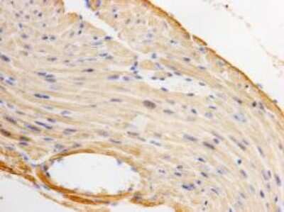Immunohistochemistry-Paraffin: Actin Alpha 1 Cardiac Muscle Antibody (33-32) [NBP2-67114] - Analysis of paraffin- embedded mouse heart tissue using anti-Alpha -cardiac actin Mouse mAb.