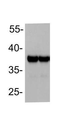 Western Blot: Actin Antibody (647) [NBP1-42279] - Analysis of Actin in HeLa and HEK 293 cell lysates (30 ug/lane) using anti-Actin antibody. WB image submitted by a verified customer review.