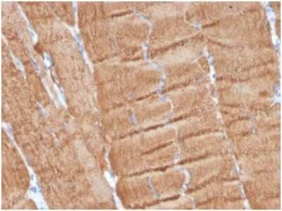 Immunohistochemistry-Paraffin: Actin Antibody (ACTA1/360) [NBP3-13759] - Formalin-fixed, paraffin-embedded human skeletal muscle stained with Actin antibody (ACTA1/360). HIER: Tris/EDTA, pH9.0, 45min. HRP-polymer, 30min. AB, 5min.