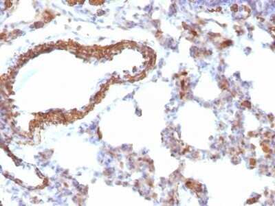 Immunohistochemistry-Paraffin: Actin (Muscle Specific) Antibody (MSA/953) - Azide and BSA Free [NBP2-47662] - Rat Lung stained with Muscle Specific Actin Monoclonal Antibody (MSA/953)