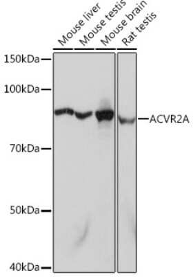 Western Blot: Activin RIIA Antibody (1K1J10) [NBP3-16598] - Western blot analysis of extracts of various cell lines, using Activin RIIA Rabbit mAb (NBP3-16598) at 1:1000 dilution. Secondary antibody: HRP Goat Anti-Rabbit IgG (H+L) at 1:10000 dilution. Lysates/proteins: 25ug per lane. Blocking buffer: 3% nonfat dry milk in TBST. Detection: ECL Basic Kit. Exposure time: 1s.