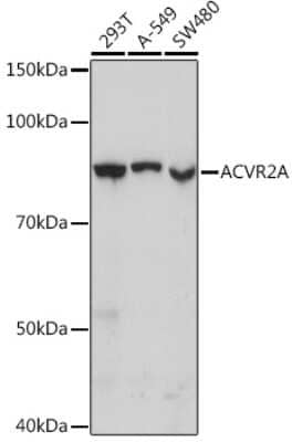 Western Blot: Activin RIIA Antibody (1K1J10) [NBP3-16598] - Western blot analysis of extracts of various cell lines, using Activin RIIA Rabbit mAb (NBP3-16598) at 1:1000 dilution. Secondary antibody: HRP Goat Anti-Rabbit IgG (H+L) at 1:10000 dilution. Lysates/proteins: 25ug per lane. Blocking buffer: 3% nonfat dry milk in TBST. Detection: ECL Basic Kit. Exposure time: 10s.