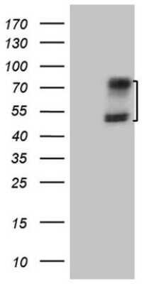 Western Blot: Activin RIIA Antibody (5D1) [NBP2-46491] - Analysis of HEK293T cells were transfected with the pCMV6-ENTRY control (Left lane) or pCMV6-ENTRY Activin RIIA.