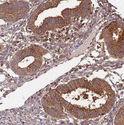 Immunohistochemistry-Paraffin: Activin RIIA Antibody [NBP1-91647] - Staining of human endometrium shows moderate to strong membranous positivity in glandular cells.