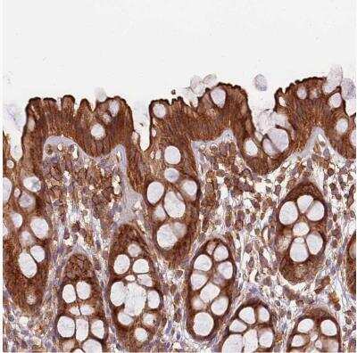 Immunohistochemistry-Paraffin: Activin RIIA Antibody [NBP1-91647] - Staining of human gastrointestinal shows moderate to strong membranous positivity in glandular cells.