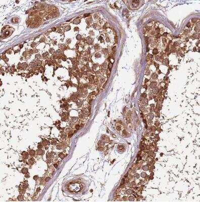 Immunohistochemistry-Paraffin: Activin RIIA Antibody [NBP1-91647] - Staining of human testis shows moderate to strong cytoplasmic positivity in cells in seminiferous ducts.