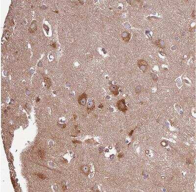 Immunohistochemistry-Paraffin: Activin RIIA Antibody [NBP1-91647] - Staining of human cerebral cortex shows moderate to strong cytoplasmic positivity in neurons.