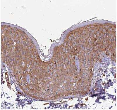 Immunohistochemistry-Paraffin: Activin RIIA Antibody [NBP1-91647] -  Staining of human skin shows moderate to strong membranous positivity in squamous epithelial cells.