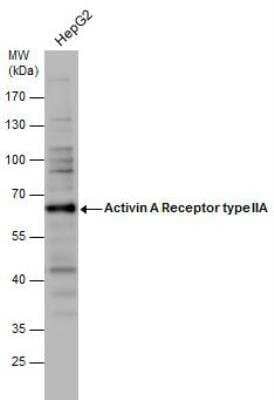 Western Blot: Activin RIIA Antibody [NBP1-33601] - Whole cell extracts (30 ug) was separated by 10% SDS-PAGE, and the membrane was blotted with Activin A Receptor type IIA antibody diluted by 1:4000.