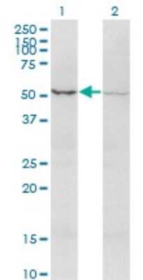 Western Blot: Activin RIIB Antibody (1C11) [H00000093-M03] - Analysis of ACVR2B expression in transfected 293T cell line by ACVR2B monoclonal antibody (M03), clone 1C11. Lane 1: ACVR2B transfected lysate (Predicted MW: 34.2 KDa). Lane 2: Non-transfected lysate.