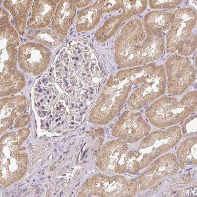 Immunohistochemistry-Paraffin: Activin RIIB Antibody [NBP2-68638] - Staining of human kidney shows moderate cytoplasmic positivity in cells in tubules.