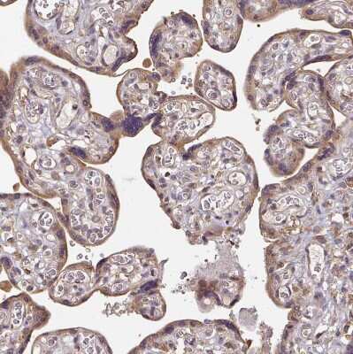 Immunohistochemistry-Paraffin: Activin RIIB Antibody [NBP2-68638] - Staining of human placenta shows moderate cytoplasmic positivity in trophoblastic cells.