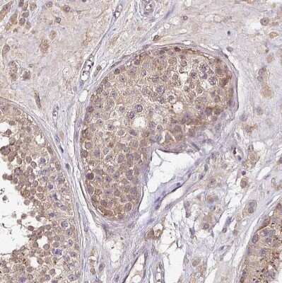 Immunohistochemistry-Paraffin: Activin RIIB Antibody [NBP2-68638] - Staining of human testis shows moderate cytoplasmic positivity in cells in seminiferous ducts.