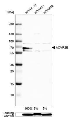 Western Blot: Activin RIIB Antibody [NBP2-68638] - Analysis in Rh30 cells transfected with control siRNA, target specific siRNA probe #1 and #2,. Remaining relative intensity is presented. Loading control: Anti-GAPDH.