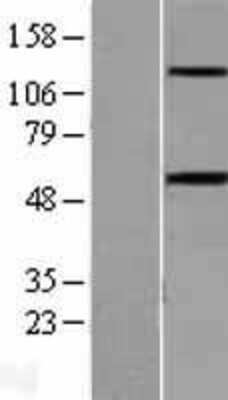 Western Blot Activin RIB/ALK-4 Overexpression Lysate