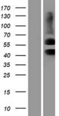Western Blot Activin RIIA Overexpression Lysate