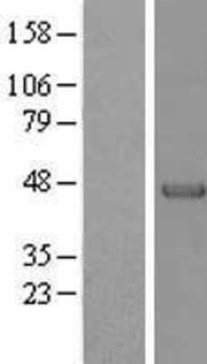 Western Blot: Alpha-parvin/Actopaxin Overexpression Lysate [NBL1-14120] -  Left-Empty vector transfected control cell lysate (HEK293 cell lysate); Right -Over-expression Lysate for Actopaxin.