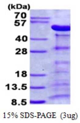 SDS-Page: Recombinant Human Alpha-parvin/Actopaxin Protein [NBP2-23317]