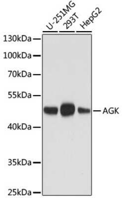Western Blot: Acylglycerol Kinase Antibody (9A3B1) [NBP3-05339] - Western blot analysis of extracts of various cell lines, using Acylglycerol Kinase antibody (NBP3-05339) at 1:1000 dilution. Secondary antibody: HRP Goat Anti-Mouse IgG (H+L) (AS003) at 1:10000 dilution. Lysates/proteins: 25ug per lane. Blocking buffer: 3% nonfat dry milk in TBST. Detection: ECL Basic Kit. Exposure time: 5s.