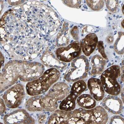 Immunohistochemistry-Paraffin: Acylglycerol Kinase Antibody [NBP1-83825] - Staining of human kidney shows strong cytoplasmic positivity in cells in tubules.