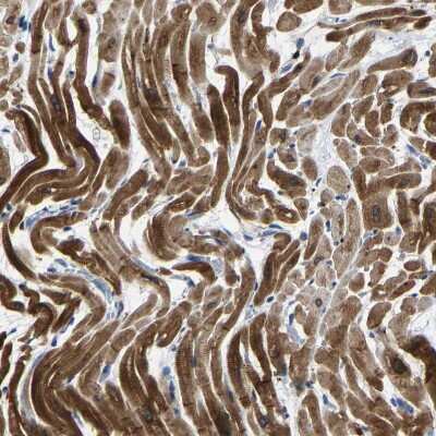 Immunohistochemistry-Paraffin: Acylglycerol Kinase Antibody [NBP1-83825] - Staining of human heart muscle shows strong cytoplasmic positivity in cardiomyocytes.