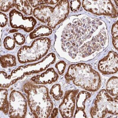 Immunohistochemistry-Paraffin Acylglycerol Kinase Antibody - BSA Free