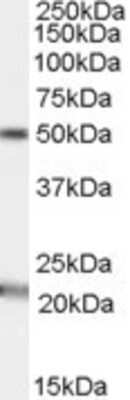 Western Blot: Acylglycerol Kinase Antibody [NBP1-06013] - Analysis of Acylglycerol Kinase using NBP1-06013 at 1ug/ml in Human Brain (Substantia nigra) lysate (35ug protein in RIPA buffer). Primary incubation was 1 hour. Detected by chemiluminescence.