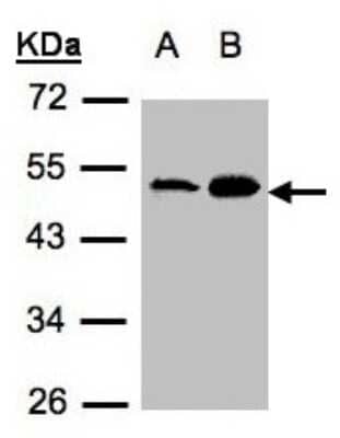 Western Blot: Acylglycerol Kinase Antibody [NBP1-32163] - Sample(30 ug of whole cell lysate) A:A431 B:H1299 10% SDS PAGE, antibody diluted at 1:500.