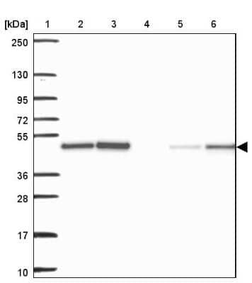 Western Blot Acylglycerol Kinase Antibody - BSA Free