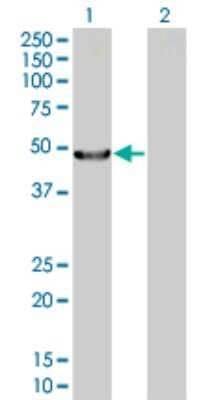 Western Blot: Acylglycerol Kinase Overexpression Lysate [H00055750-T01] - Lane 1: AGK transfected lysate (47.1 KDa) Lane 2: Non-transfected lysate.