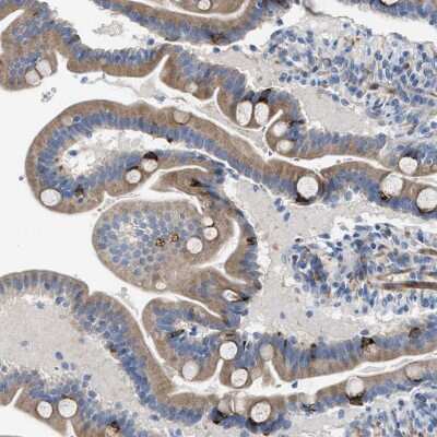 Immunohistochemistry: Acyloxyacyl Hydrolase Antibody [NBP2-33892] - Staining of human duodenum shows strong positivity in Goblet cells.