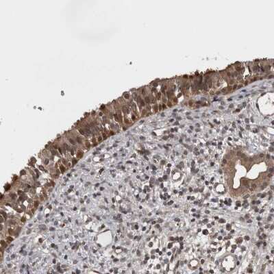 Immunohistochemistry Acyloxyacyl Hydrolase Antibody - BSA Free