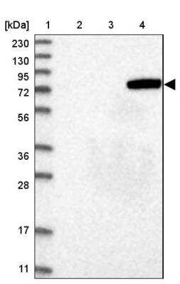 Western Blot: Acyloxyacyl Hydrolase Antibody [NBP2-33892] - Lane 1: Marker  [kDa] 230, 130, 95, 72, 56, 36, 28, 17, 11.  Lane 2: Human cell line RT-4.  Lane 3: Human cell line U-251MG sp.  Lane 4: Human plasma (IgG/HSA depleted)