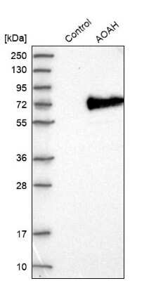 Western Blot Acyloxyacyl Hydrolase Antibody - BSA Free
