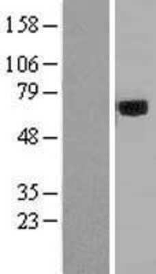 Western Blot Acyloxyacyl Hydrolase Overexpression Lysate