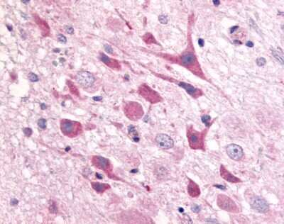 Immunohistochemistry-Paraffin: Adenosine A1 R Antibody [NLS9] - Analysis of anti-Adenosine A1 Receptor antibody of rat brain, neurons.