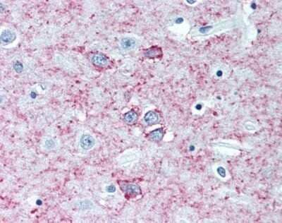 Immunohistochemistry: Adenosine A2aR Antibody (7F6-G5-A2) - Azide and BSA Free [NBP2-80562] - Staining of human brain (putamen), antibody at 5 ug/mL. Image from the standard format of this antibody.